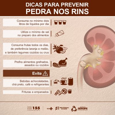 A melhor forma de prevenir pedra nos rins é adotar uma dieta saudável e evitar o alto consumo de sal. Imagem: Secretaria de Estado da Saúde de Sergipe